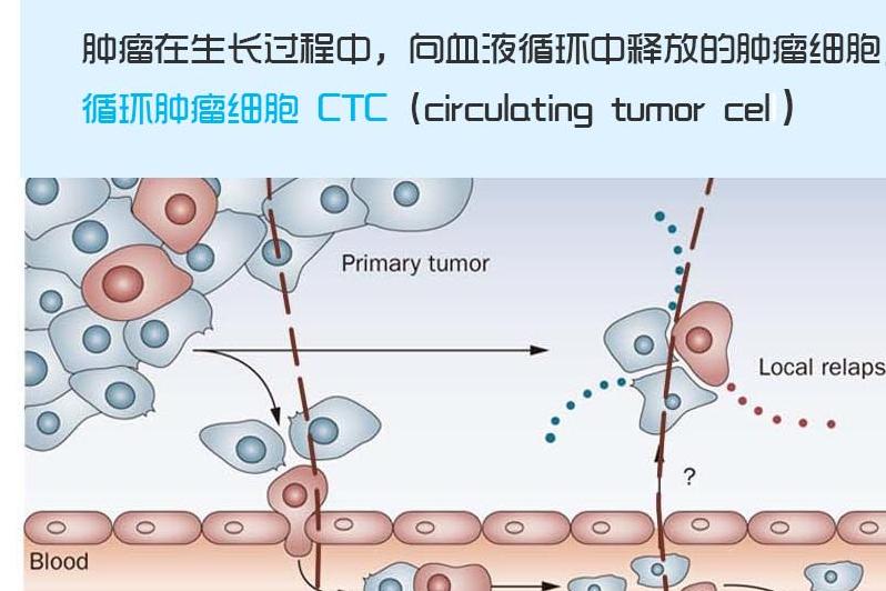 循环肿瘤细胞